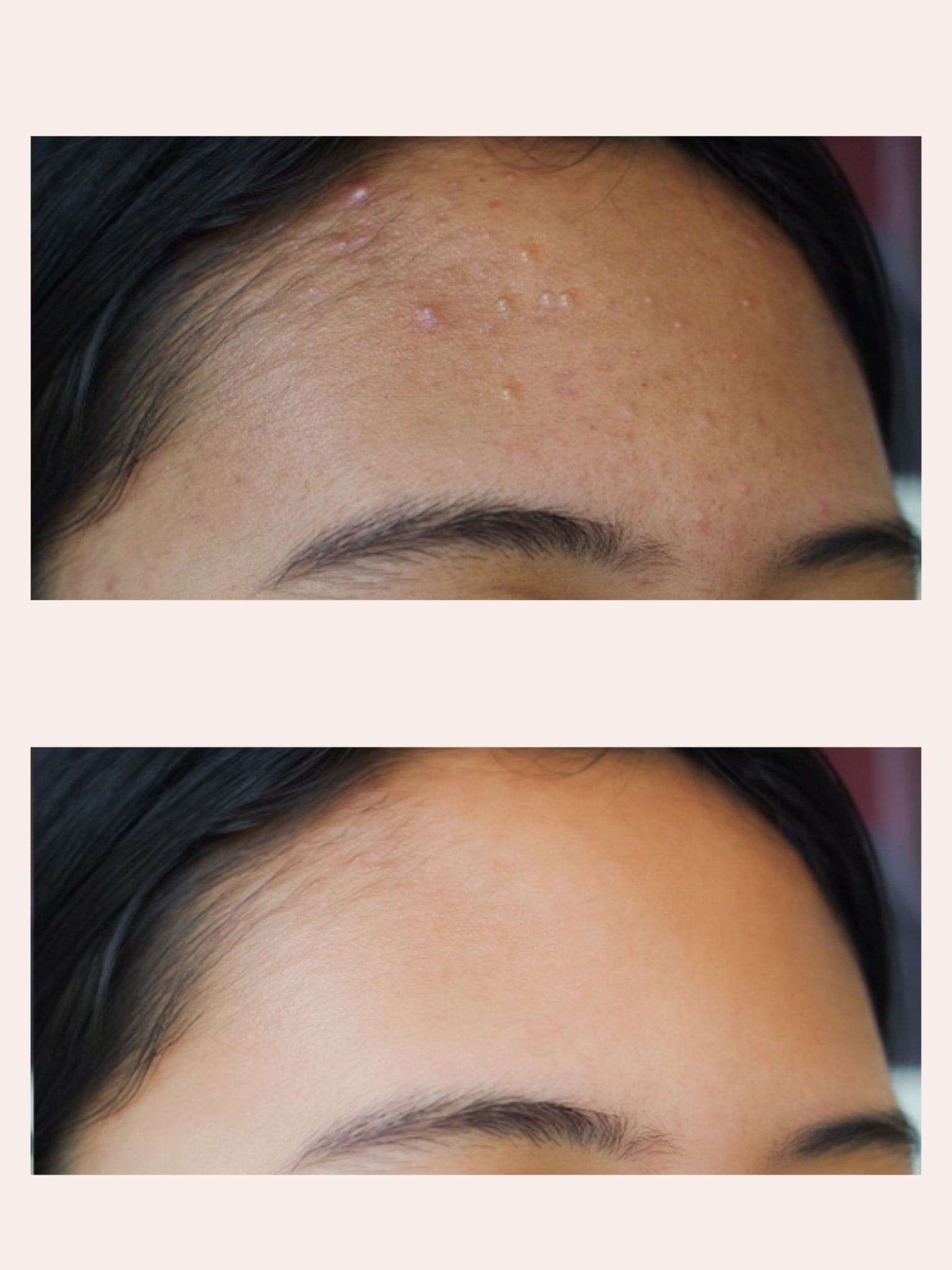 Miracles & More Gentle Oily Skin Face TonerMiracles & MoreMiracles & More